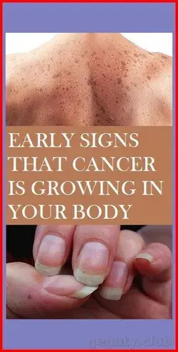 EARLY WARNING SIGNS THAT CANCER IS GROWING IN YOUR BODY!