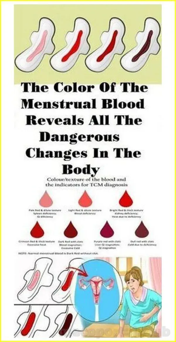 COLOR OF PERIOD BLOOD AND WOMAN HEALTH