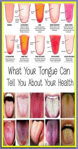 WHAT DOES YOUR TONGUE SAY ABOUT YOUR HEALTH?