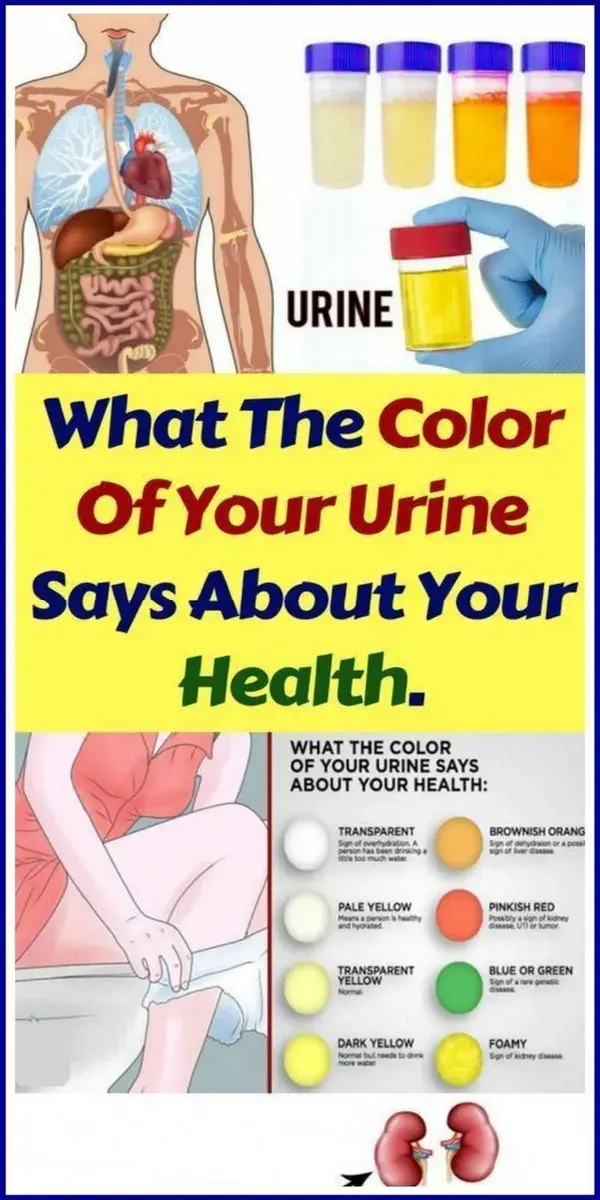 What The Color of Your Urine Says About Your Health - Urine Color Meaning