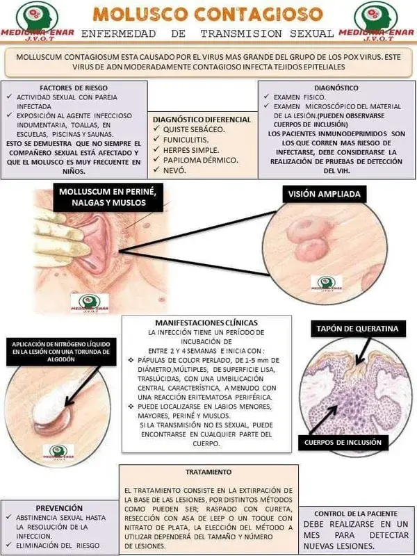 Tu vagina también envejece: ¡Empieza a cuidarla a tiempo!