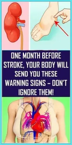 One Month Before Stroke, Your Body Will Send You These Warning Signs ? Don�t Ignore Them!