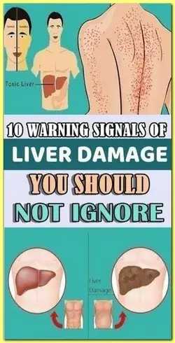 10 Warning Signals of Liver Damage You Should Not Ignore