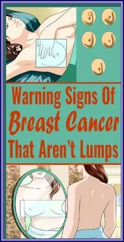 Warning Signs Of Breast Cancer That Aren�t Lumps