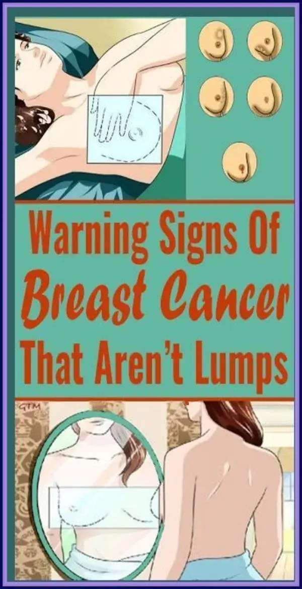 Warning Signs Of Breast Cancer That Aren�t Lumps