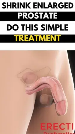 Shrink enlarged prostate do this simple treatment