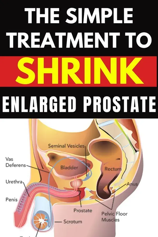 Prostate Health Men: How to Shrink An Enlarged Prostate