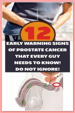 12 EARLY WARNING SIGNS OF PROSTATE CANCER THAT EVERY GUY NEEDS TO KNOW! DO NOT IGNORE