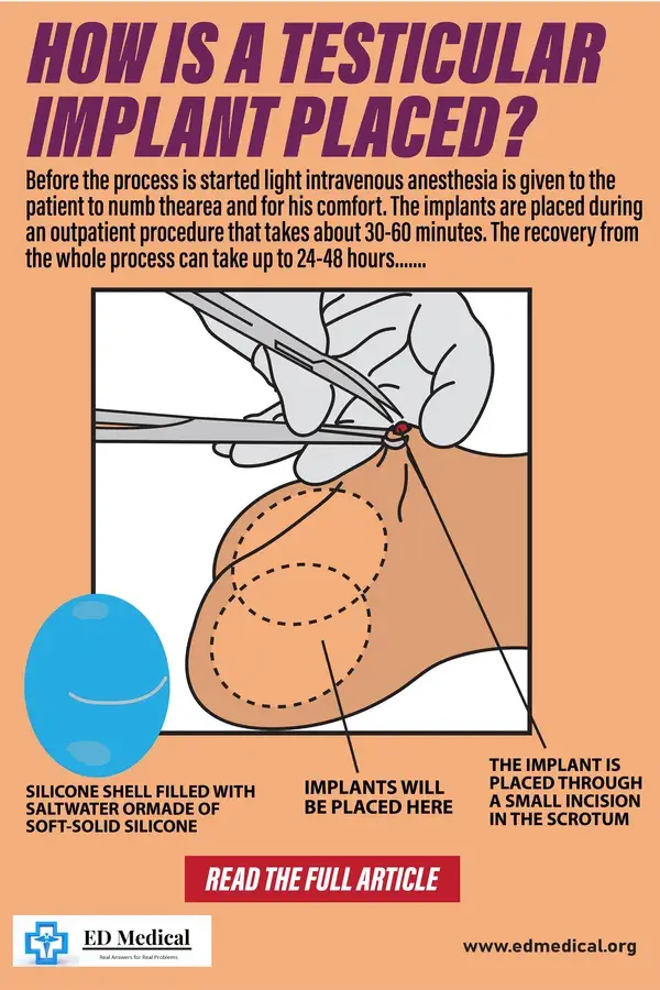 How is a testicular implant placed?