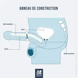 Anneau de constriction