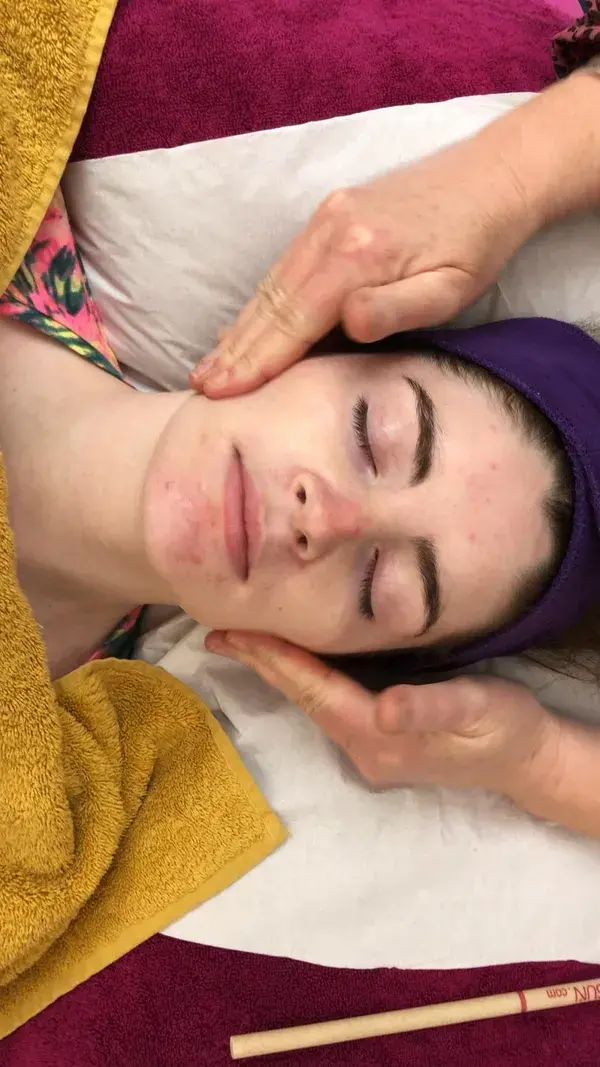 Facial video