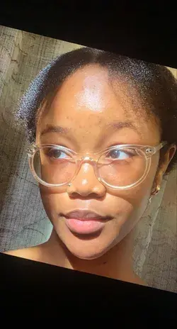 Skin and glasses 😊