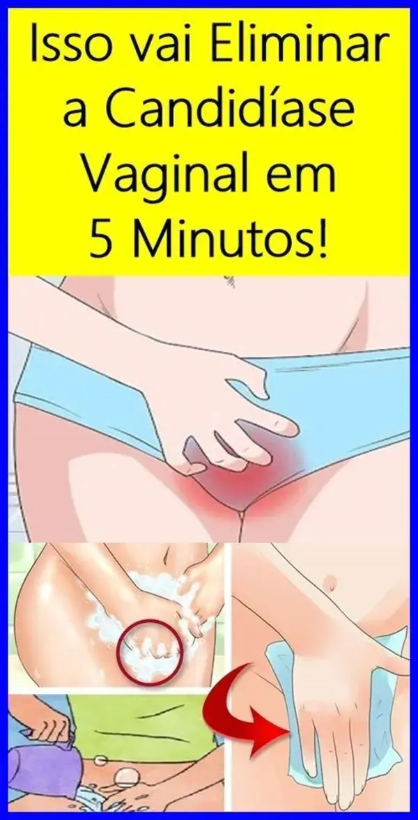 Eu Usei Isso Para Eliminar a Minha Candidíase Vaginal em Minutos!