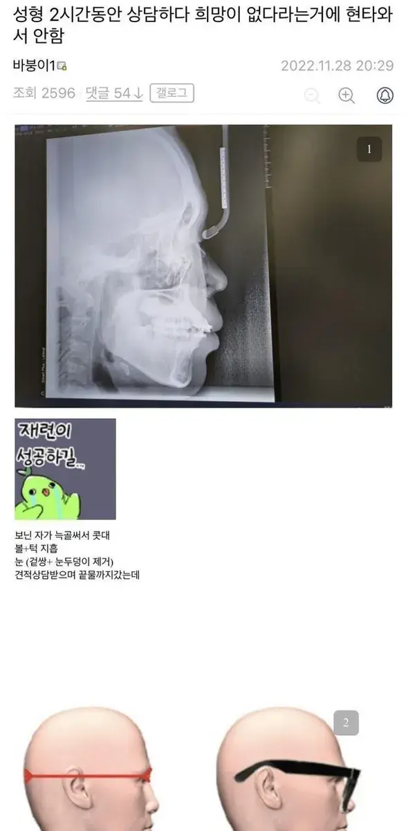 성형 상담 받다가 현타온 디씨인