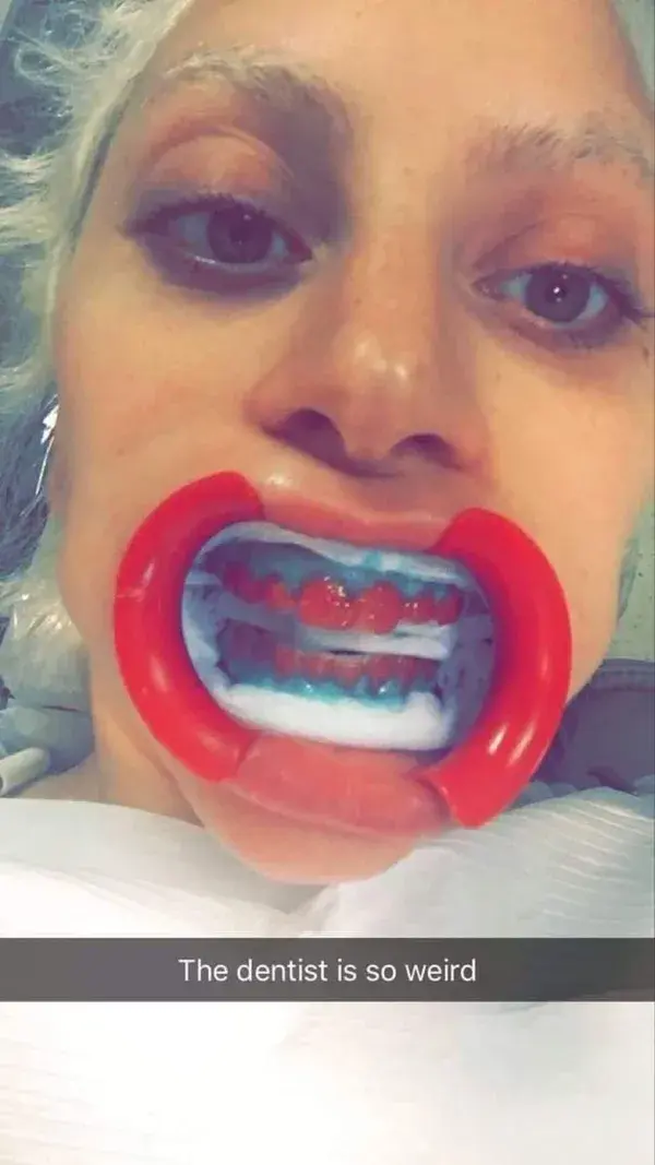 lady gaga at the dentist