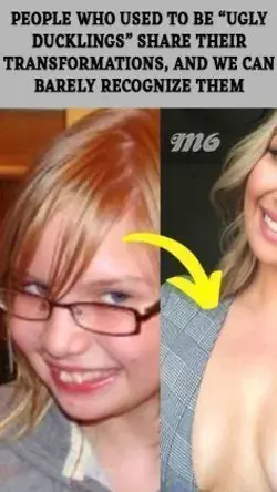 People Who Used To Be “Ugly Ducklings” Share Their Transformations, And We Can Barely Recognize Them