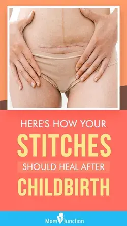 Here’s How Your Stitches Should Heal After The Birth