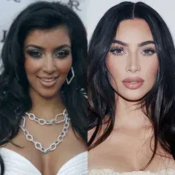 Kim kardashian before and after
