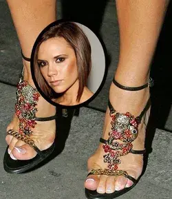 12 A-List Celebrities with Bunions 