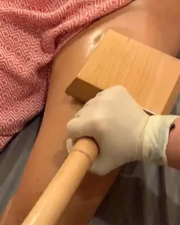 ⭐️ Maderotherapy- Wood Therapy ⭐️