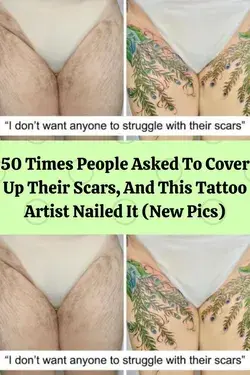 50 Times People Asked To Cover Up Their Scars, And This Tattoo Artist Nailed It (New Pics)