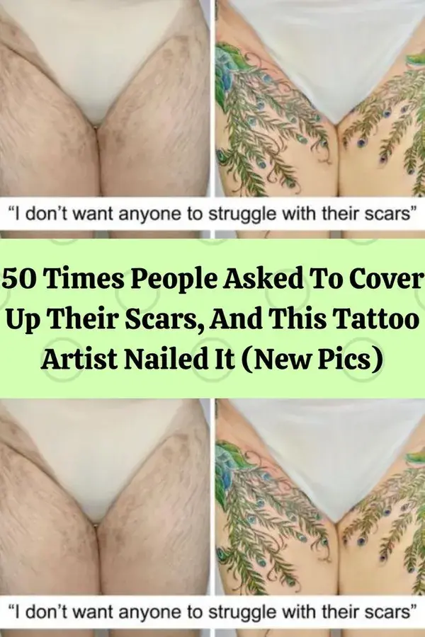 50 Times People Asked To Cover Up Their Scars, And This Tattoo Artist Nailed It (New Pics)