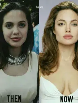 Did Angelina Jolie ever say anything about plastic surgery?