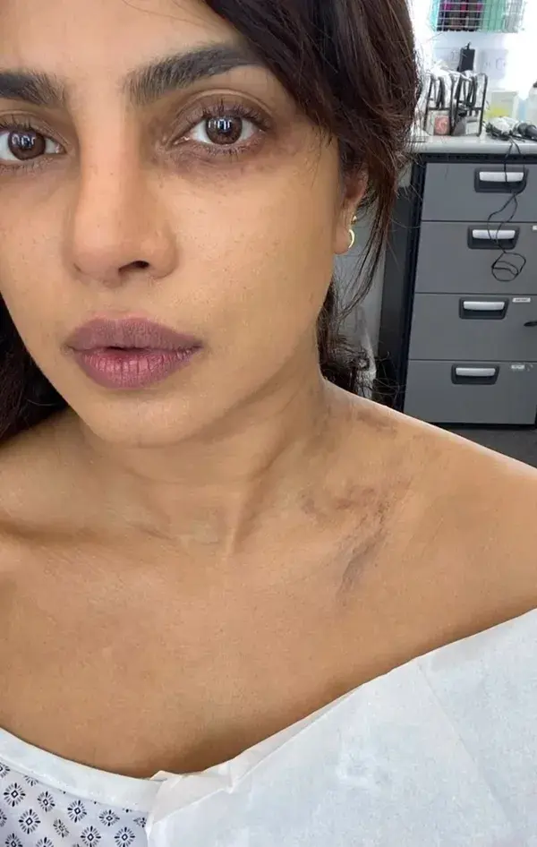 Priyanka Chopra