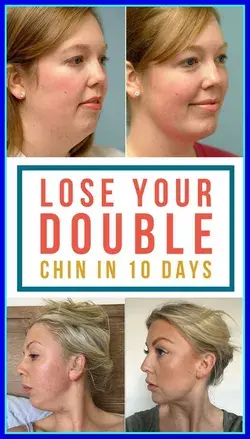 Home remedies and facial exercise to get rid of double chin wrap overnight.