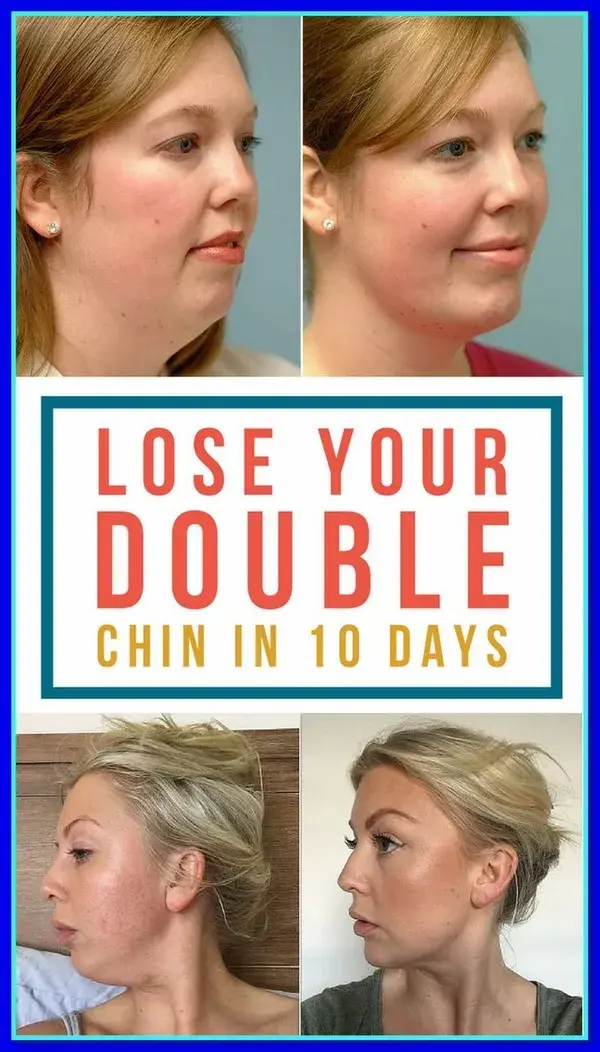 Home remedies and facial exercise to get rid of double chin wrap overnight.