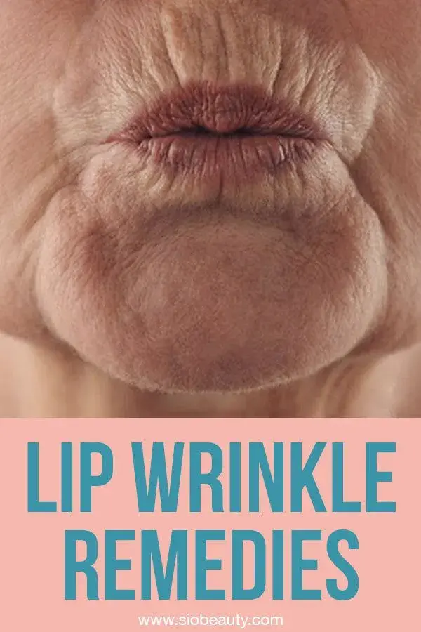 How To Remove Deep Mouth Wrinkles Really Fast