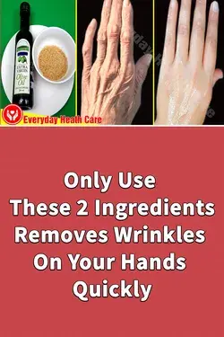 Only Use These 2 Ingredients - Removes Wrinkles On Your Hands Quickly