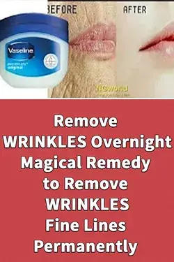 Remove WRINKLES Overnight, Magical Remedy to Remove WRINKLES, Fine Lines Permanently