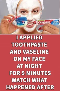 I APPLIED TOOTHPASTE AND VASELINE ON MY FACE AT NIGHT FOR 5 MINUTES, WATCH WHAT HAPPENED AFTER 