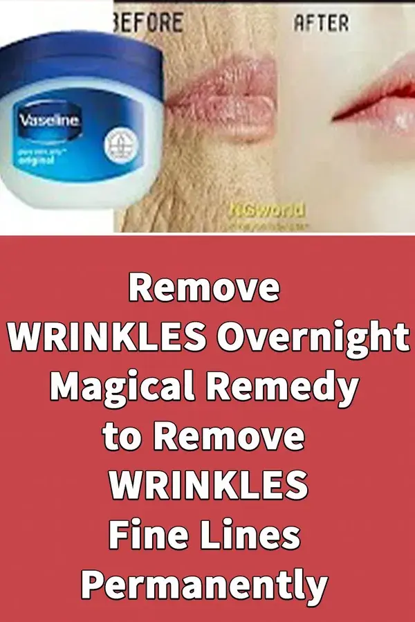 Remove WRINKLES Overnight, Magical Remedy to Remove WRINKLES, Fine Lines Permanently