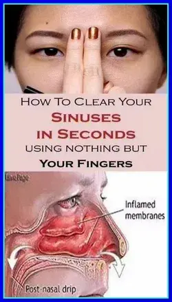 How to Clear Your Sinuses in Seconds Using Nothing But Your Fingers
