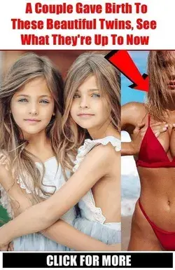 A Couple Gave Birth To These Beautiful Twins, Here's What They're Up To Now | Buzzerilla