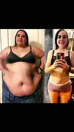 My Incredible Weight Loss Makeover: Before and After