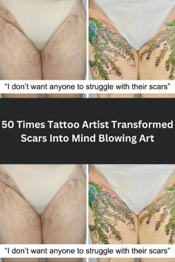 50 Times Tattoo Artist Transformed Scars Into Mind Blowing Art