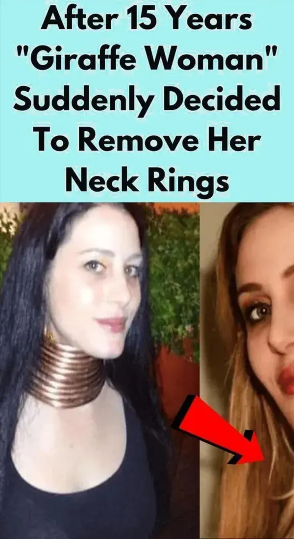 After 15 Years "Giraffe Woman" Suddenly Decided To Remove Her Neck Rings__