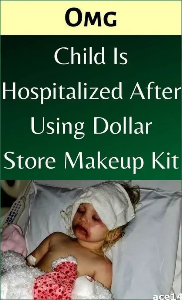 After Makeup Kit Leads To Hospitalized Girl, Parents Warn Others Of Dangers Of Makeup Chemicals