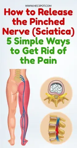 How to Release the Pinched Nerve in the Lumbar Area (sciatica)