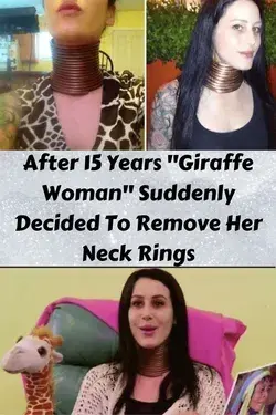 After 15 Years "Giraffe Woman" Suddenly Decided To Remove Her Neck Rings