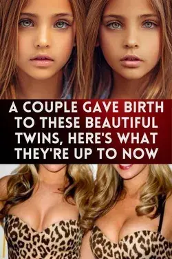 A Couple Gave Birth To These Beautiful Twins, Here's What They're Up To Now