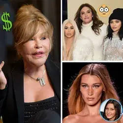 Celebrities Who Spent A Fortune Changing Their Looks