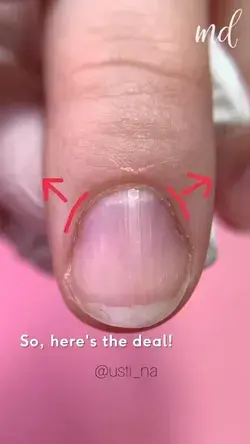 TRAPEZOIDAL NAILS