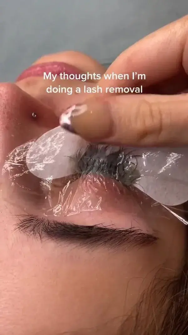 lashremoval