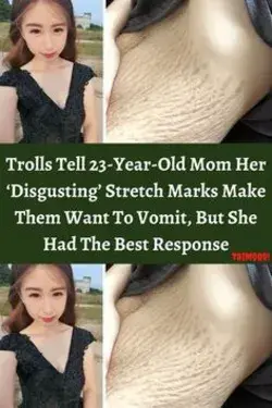 Trolls Tell 23-Year-Old Mom Her ‘Disgusting’ Stretch