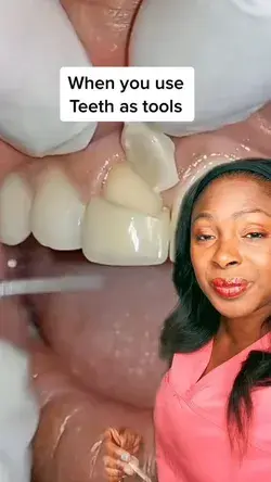 when you use teeth as tools