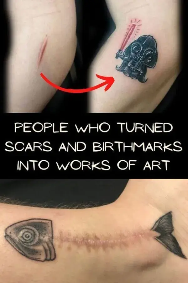 People Who Turned Scars and Birthmarks Into Works of Art